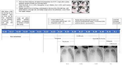 A case report of severe pulmonary legionellosis caused by Legionella bozemanae